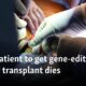 First patient to get gene-edited pig kidney transplant dies 