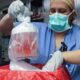 First Person to Receive Pig Kidney Transplant Dies