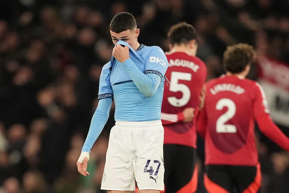 Phil Foden’s frustration at City’s derby defeat was clear (PA Wire)