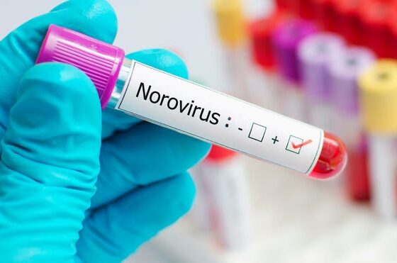 What is norovirus? What to know as stomach flu cases rise