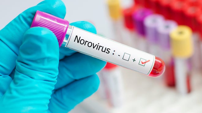 What is norovirus? What to know as stomach flu cases rise